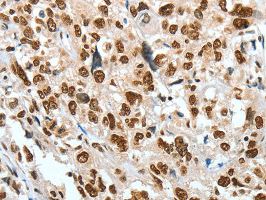 BNIP1 Polyclonal Antibody Store at -20°C