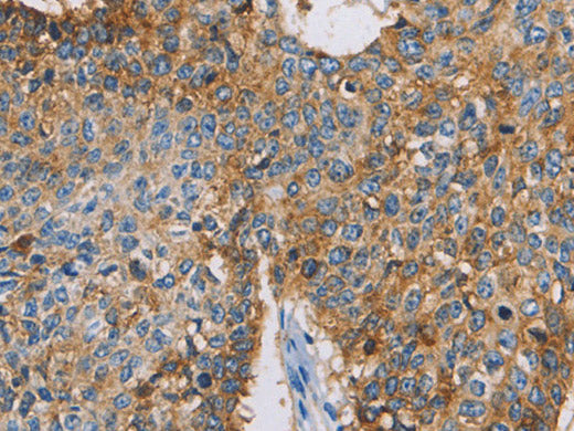 CDCP1 Polyclonal Antibody