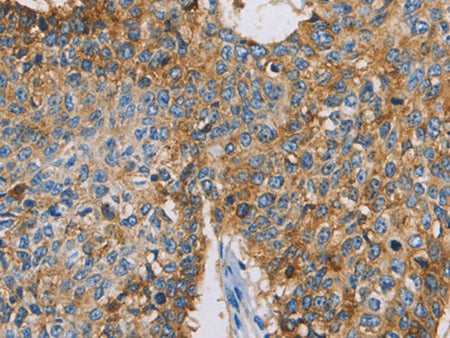 CDCP1 Polyclonal Antibody