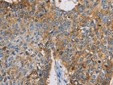 CDCP1 Polyclonal Antibody