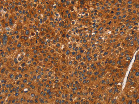 CDK19 Polyclonal Antibody Store at -20°C