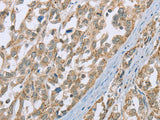 ECHS1 Polyclonal Antibody