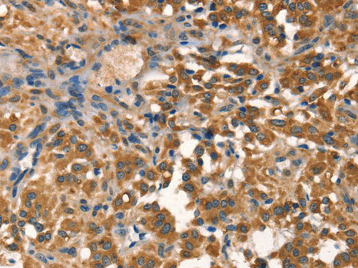 AGO1 Polyclonal Antibody Store at -20°C