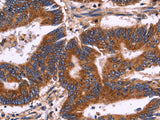 KIR2DL1/3/4/S4 Polyclonal Antibody Store at -20°C
