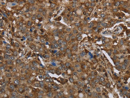 ARHGDIA Polyclonal Antibody Store at -20°C