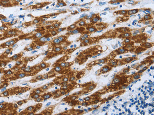 ALDOA Polyclonal Antibody Store at -20°C