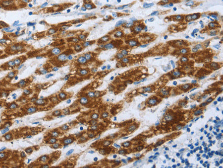 ALDOA Polyclonal Antibody Store at -20°C
