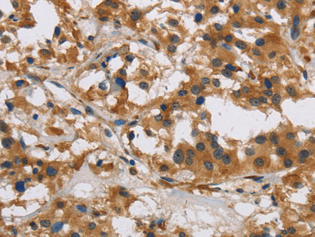 IL17RB Polyclonal Antibody Store at -20°C