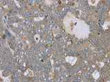 FAR2 Polyclonal Antibody