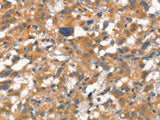 VE-Cadherin Polyclonal Antibody