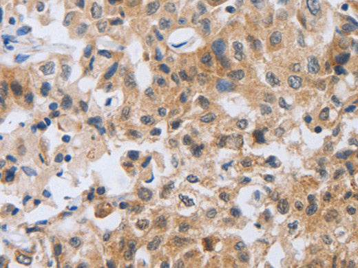 NFATC2 Polyclonal Antibody Store at -20°C