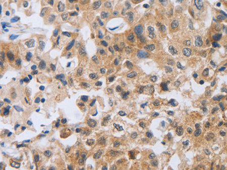 NFATC2 Polyclonal Antibody Store at -20°C