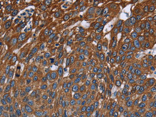 FCGR3A Polyclonal Antibody Store at -20°C
