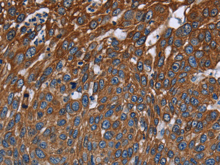 FCGR3A Polyclonal Antibody Store at -20°C