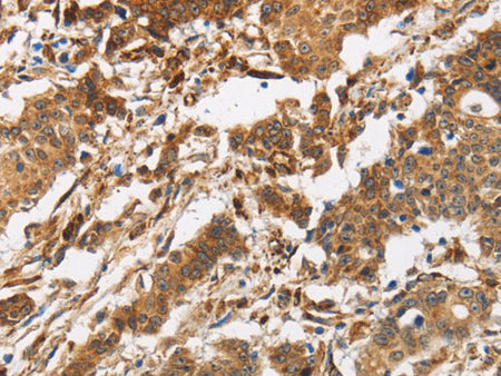 CALU Polyclonal Antibody Store at -20°C