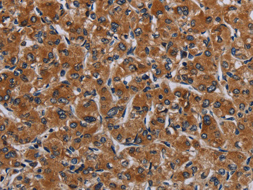 IRGM Polyclonal Antibody Store at -20°C