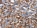 CD226 Polyclonal Antibody Store at -20°C