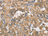 PLEKHO1 Polyclonal Antibody