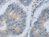 MAGEB4 Polyclonal Antibody
