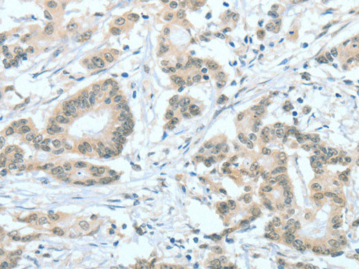 ASH2L Polyclonal Antibody Store at -20°C