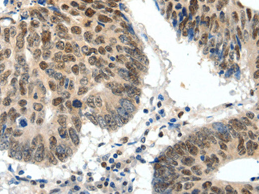TOP2A Polyclonal Antibody Store at -20°C
