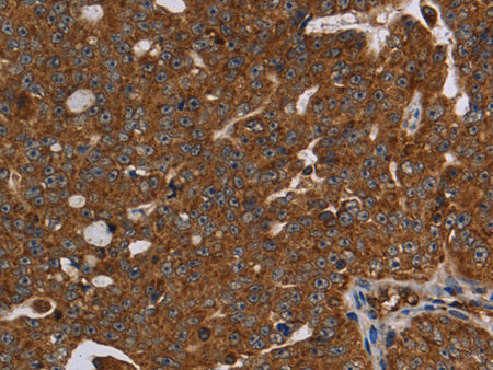HSD17B13 Polyclonal Antibody Store at -20°C