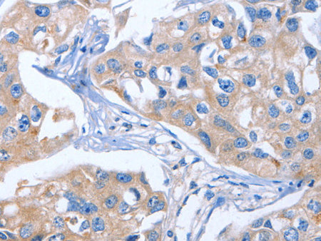 IBSP Polyclonal Antibody Store at -20°C