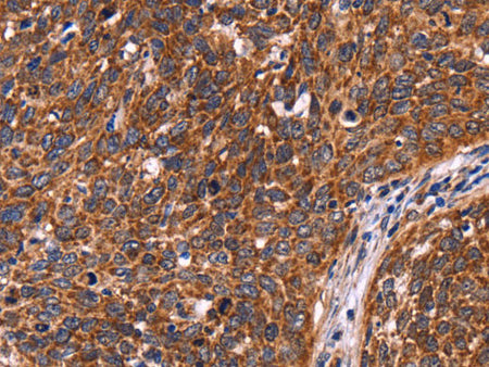CCDC106 Polyclonal Antibody Store at -20°C