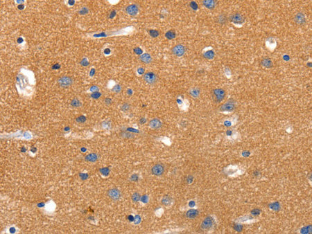 JAK2 Polyclonal Antibody Store at -20°C