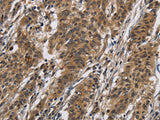 IL12RB2 Polyclonal Antibody Store at -20°C
