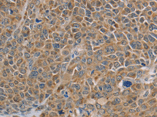 NDUFS7 Polyclonal Antibody Store at -20°C