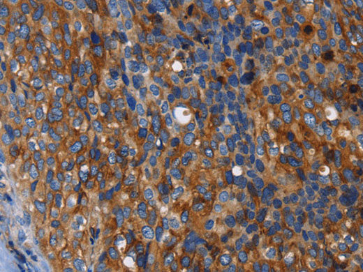 MSLN Polyclonal Antibody Store at -20°C
