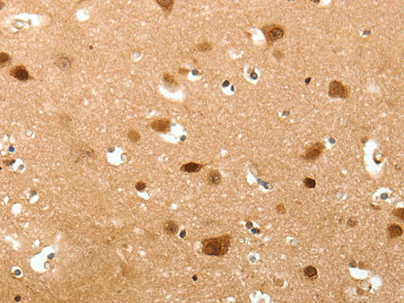 TNN Polyclonal Antibody Store at -20°C