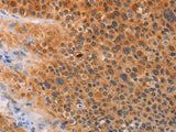 ADHFE1 Polyclonal Antibody Host Rabbit