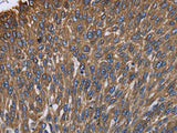 KRT31 Polyclonal Antibody