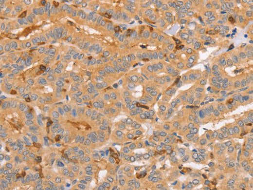 CCL16 Polyclonal Antibody Store at -20°C
