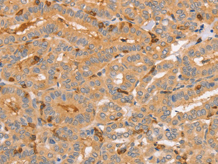 CCL16 Polyclonal Antibody Store at -20°C