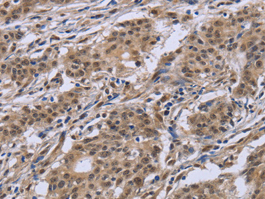 IPO8 Polyclonal Antibody Store at -20°C