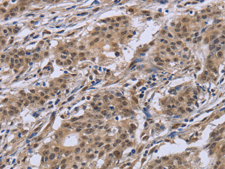 IPO8 Polyclonal Antibody Store at -20°C