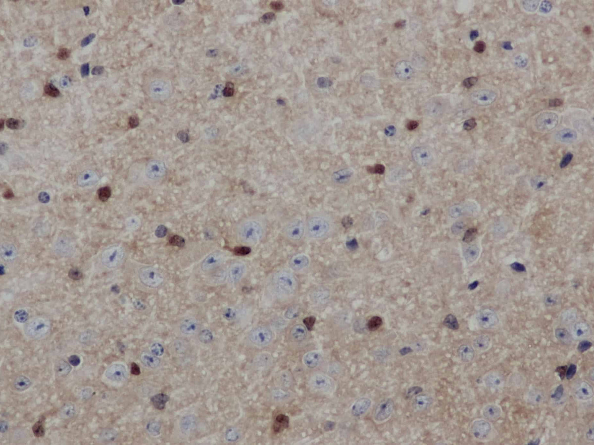 ENO1 Polyclonal Antibody Store at -20°C