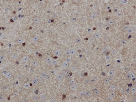 ENO1 Polyclonal Antibody Store at -20°C