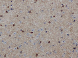 ENO1 Polyclonal Antibody Store at -20°C
