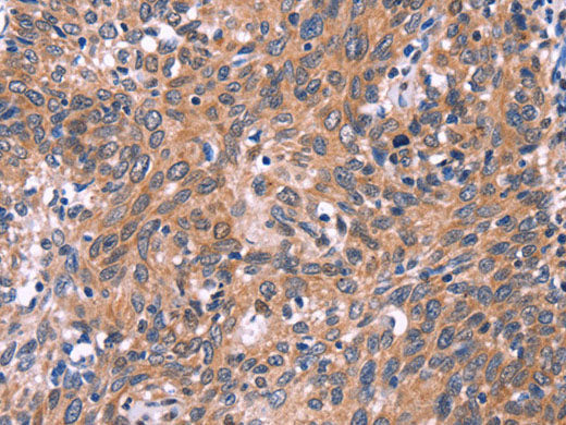 EDN1 Polyclonal Antibody Store at -20°C