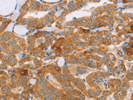 CARD6 Polyclonal Antibody Store at -20°C