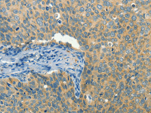BCAT1 Polyclonal Antibody Store at -20°C