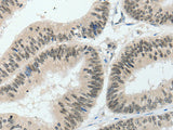 HNF1B Polyclonal Antibody Store at -20°C