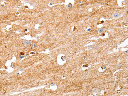 S100B Polyclonal Antibody Store at -20°C