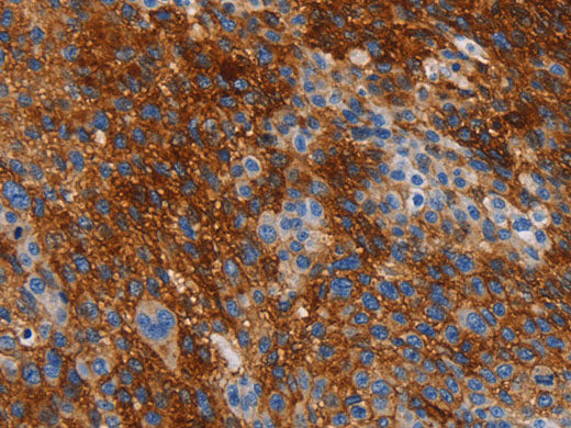 CA9 Polyclonal Antibody Store at -20°C