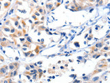 Fibulin 5 Polyclonal Antibody