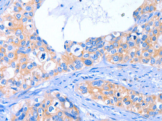 ARRB1 Polyclonal Antibody Store at -20°C